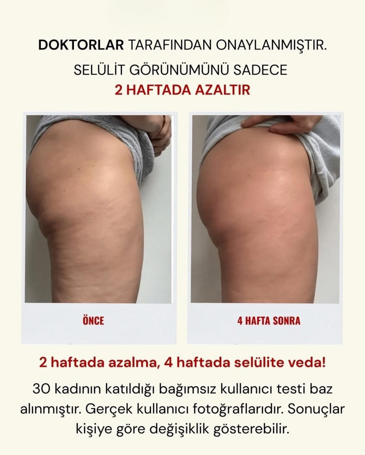 3'lü etkili Lipödem, Selülit, Varis Taytı